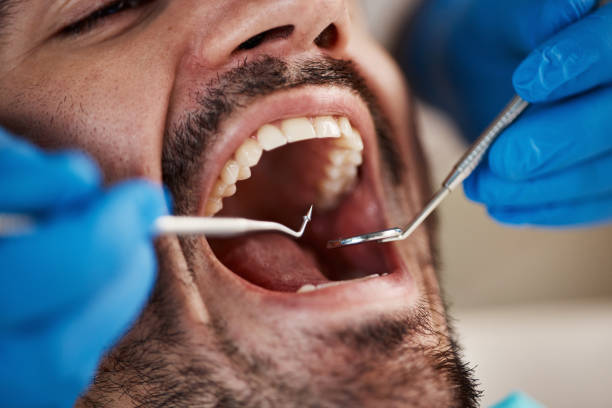 Best Broken or Chipped Tooth Repair in Haledon, NJ