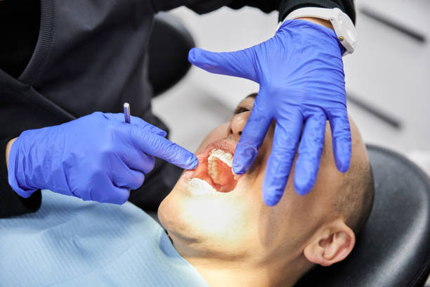 Best Emergency Wisdom Tooth Extraction in Haledon, NJ
